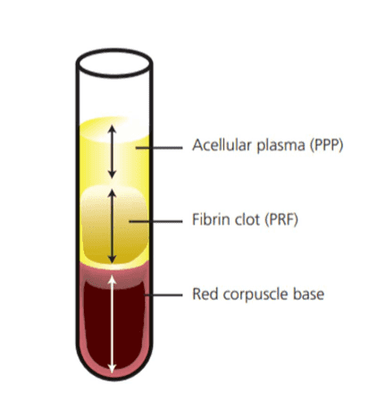 Plasma Photo